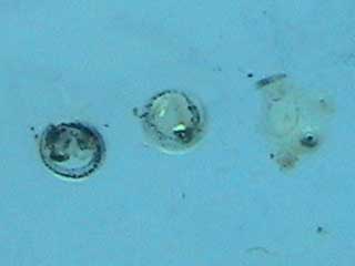 水カビ病に侵されたメダカの卵の拡大写真